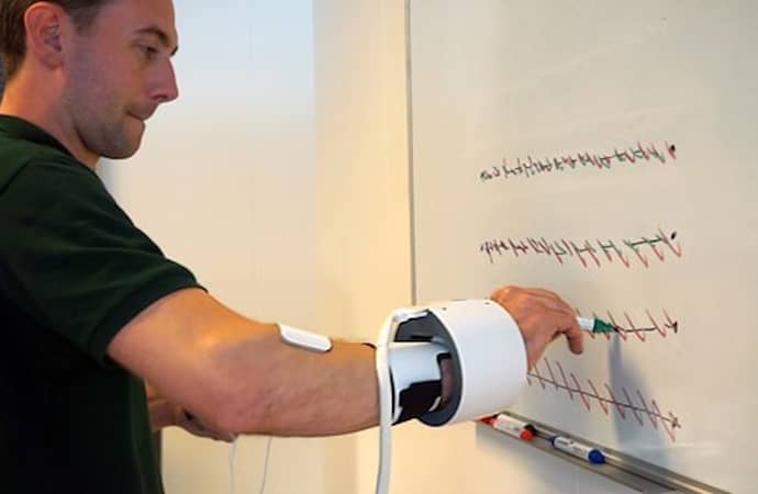 STIL - Anti Tremor Orthosis Device